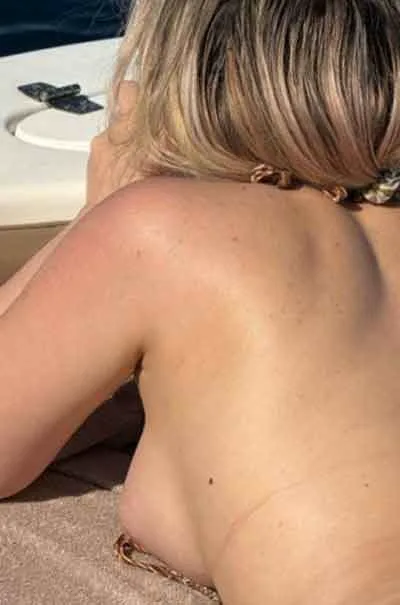 Klara, 25 år